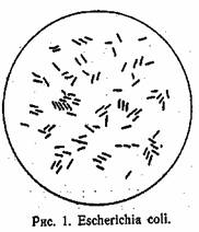 Микробиология. кишечная палочка. 