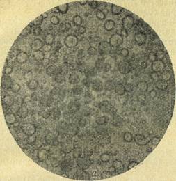 Крахмальные зерна под микроскопом